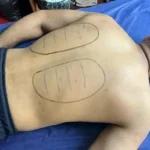 ماساژ برای افزایش اکسیژن خون