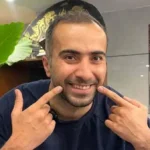 آموزش ماساژ خط خنده