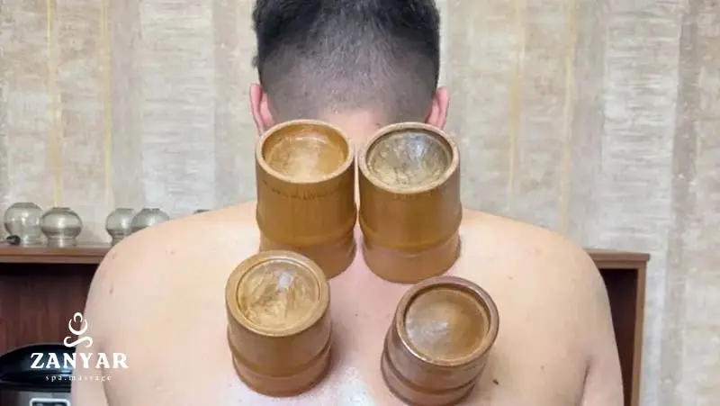 روش های بادکش