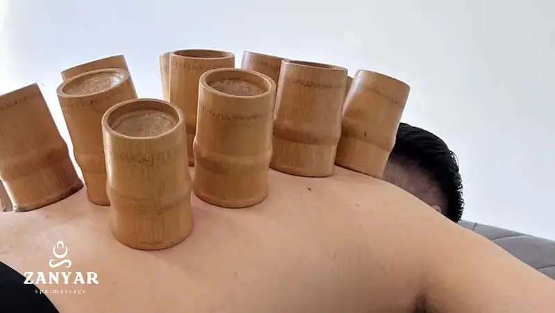موارد منع بادکش