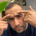 ماساژ خط اخم