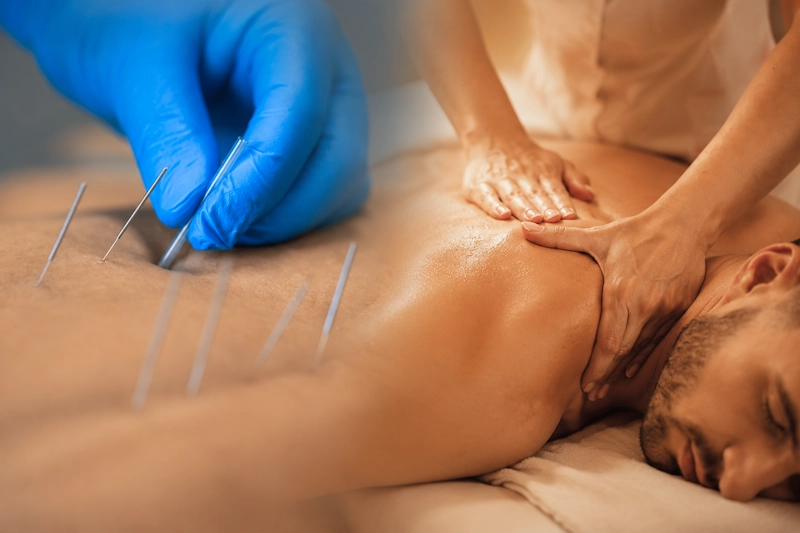 تفاوت ماساژ و طب سوزنی چیست؟